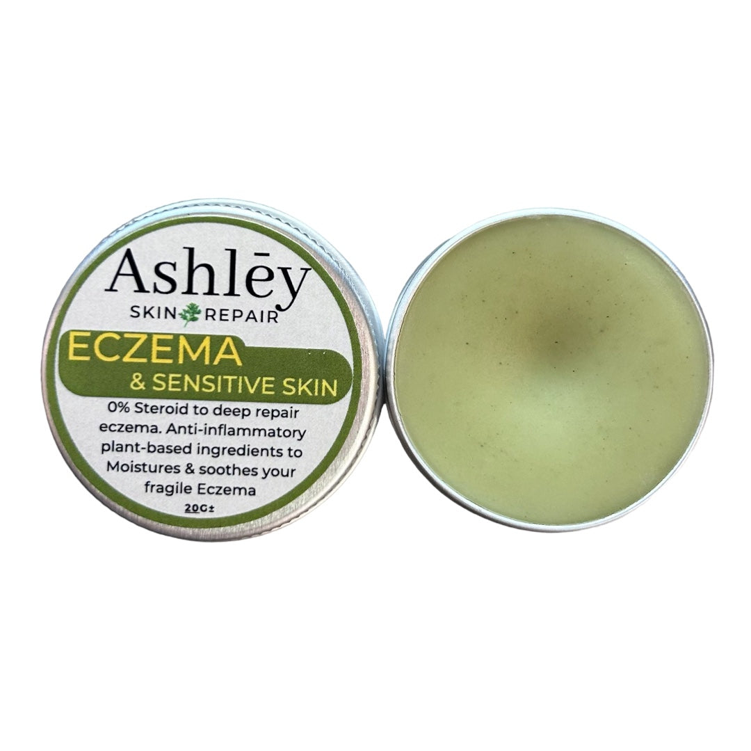 ECZEMA & SENSITIVE SKIN BALM